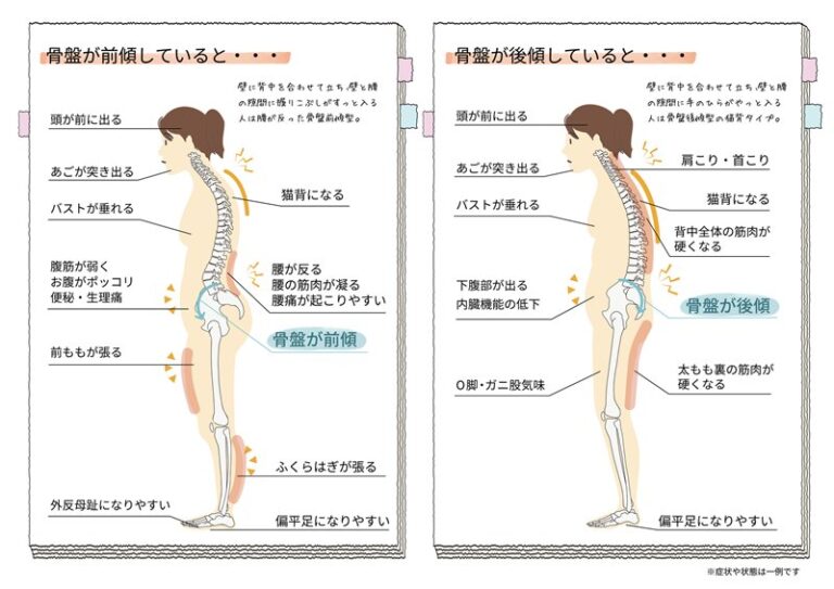 猫背(背骨)と骨盤の関係